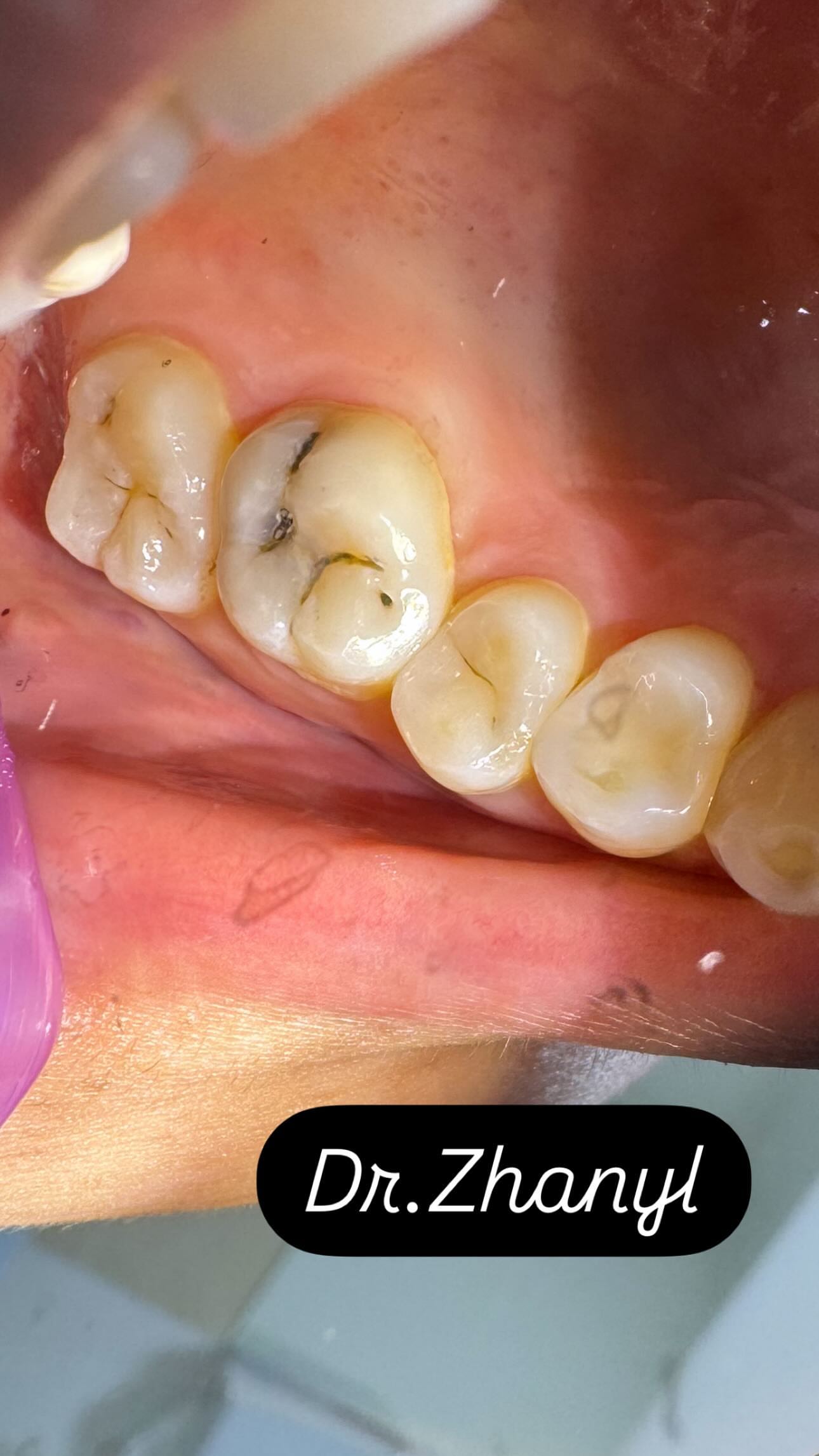 Работы Dr. Жаныл