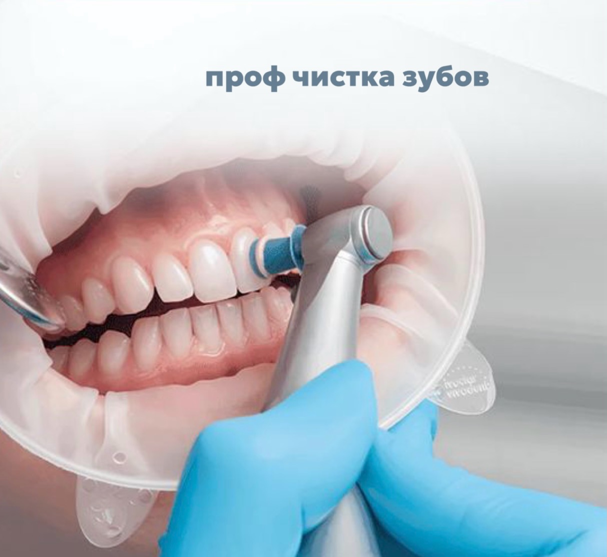 Профессиональная гигиена